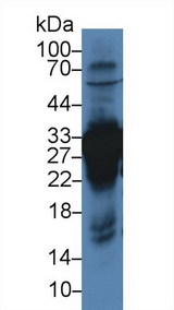 CA3 / Carbonic Anhydrase III Antibody - Western Blot; Sample: Rat Liver lysate; Primary Ab: 3µg/ml Rabbit Anti-Rat CA3 Antibody Second Ab: 0.2µg/mL HRP-Linked Caprine Anti-Rabbit IgG Polyclonal Antibody