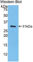 CA3 / Carbonic Anhydrase III Antibody - Western Blot; Sample: Recombinant CA3, Human.