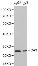 CA3 / Carbonic Anhydrase III Antibody - Western blot of CA3 pAb in extracts from Hela and 293 cells.