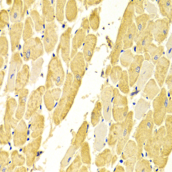 CA3 / Carbonic Anhydrase III Antibody - Immunohistochemistry of paraffin-embedded rat heart using CA3 Antibodyat dilution of 1:100 (40x lens).