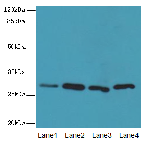 CA3 / Carbonic Anhydrase III Antibody - Western blot. All lanes: CA3 antibody at 2 ug/ml. Lane 1: HeLa whole cell lysate. Lane 2: HepG-2 whole cell lysate. Lane 3: K562 whole cell lysate. Lane 4: NIH/3T3 whole cell lysate. Secondary Goat polyclonal to Rabbit IgG at 1:10000 dilution. Predicted band size: 30 kDa. Observed band size: 30 kDa.