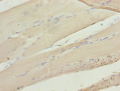 CA3 / Carbonic Anhydrase III Antibody - Immunohistochemistry of paraffin-embedded human skeletal muscle tissue using CA3 Antibody at dilution of 1:100