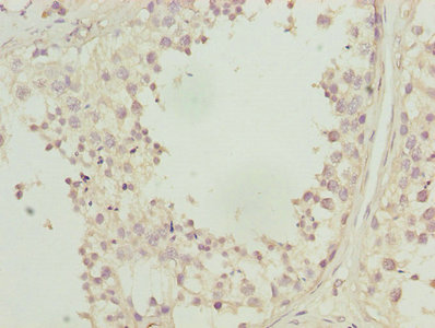 CA3 / Carbonic Anhydrase III Antibody - Immunohistochemistry of paraffin-embedded human testis tissue using CA3 Antibody at dilution of 1:100