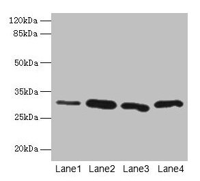 CA3 / Carbonic Anhydrase III Antibody - Western blot All lanes: CA3 antibody at 2µg/ml Lane 1: Hela whole cell lysate Lane 2: HepG2 whole cell lysate Lane 3: K562 whole cell lysate Lane 4: NIH/3T3 whole cell lysate Secondary Goat polyclonal to rabbit IgG at 1/10000 dilution Predicted band size: 30 kDa Observed band size: 30 kDa