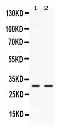 CA3 / Carbonic Anhydrase III Antibody - Western blot - Anti-CA3/Carbonic Anhydrase Iii Picoband Antibody