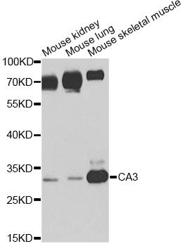 CA3 / Carbonic Anhydrase III Antibody - Western blot analysis of extracts of various cell lines, using CA3 antibody at 1:1000 dilution. The secondary antibody used was an HRP Goat Anti-Rabbit IgG (H+L) at 1:10000 dilution. Lysates were loaded 25ug per lane and 3% nonfat dry milk in TBST was used for blocking.