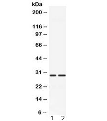 CA3 / Carbonic Anhydrase III Antibody - Western blot testing of 1) rat muscle and 2) mouse muscle with CA3 antibody at 0.5ug/ml. Predicted/observed molecular weight ~29 kDa.