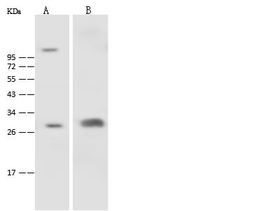 CA3 / Carbonic Anhydrase III Antibody - Anti-CA3 rabbit polyclonal antibody at 1:500 dilution. Lane A: Mouse spleen tissue lysate. Lane B: Mouse pancreas tissue lysate. Lysates/proteins at 30 ug per lane. Secondary: Goat Anti-Rabbit IgG (H+L)/HRP at 1/10000 dilution. Developed using the ECL technique. Performed under reducing conditions. Predicted band size: 30 kDa. Observed band size: 30 kDa.