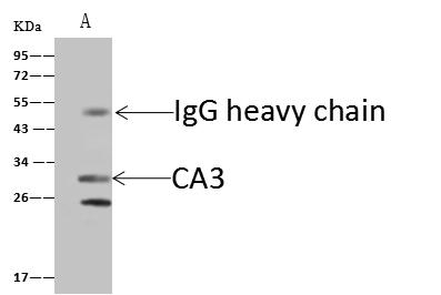 CA3 / Carbonic Anhydrase III Antibody - CA3 was immunoprecipitated using: Lane A: 0.5 mg Mouse pancreas Whole Cell Lysate. 4 uL anti-CA3 rabbit polyclonal antibody and 60 ug of Immunomagnetic beads Protein A/G. Primary antibody: Anti-CA3 rabbit polyclonal antibody, at 1:100 dilution. Secondary antibody: Goat Anti-Rabbit IgG (H+L)/HRP at 1/10000 dilution. Developed using the ECL technique. Performed under reducing conditions. Predicted band size: 30 kDa. Observed band size: 28 kDa.