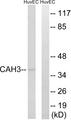 CA3 / Carbonic Anhydrase III Antibody - Western blot analysis of extracts from HUVEC cells, using CA3 antibody.