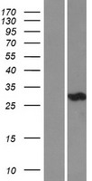 CA3 / Carbonic Anhydrase III Protein - Western validation with an anti-DDK antibody * L: Control HEK293 lysate R: Over-expression lysate