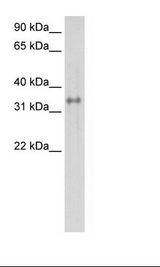 CA4 / Carbonic Anhydrase IV Antibody - Fetal Lung Lysate.  This image was taken for the unconjugated form of this product. Other forms have not been tested.