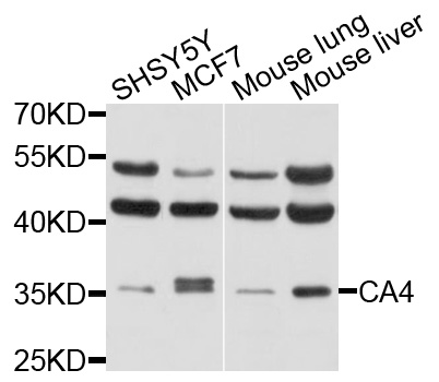CA4 / Carbonic Anhydrase IV Antibody - Western blot analysis of extracts of various cells.