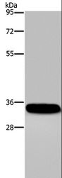 CA4 / Carbonic Anhydrase IV Antibody - Western blot analysis of Human normal lung tissue, using CA4 Polyclonal Antibody at dilution of 1:300.