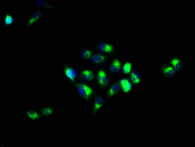 CA4 / Carbonic Anhydrase IV Antibody - Immunofluorescence staining of Hela cells with CA4 Antibody at 1:66, counter-stained with DAPI. The cells were fixed in 4% formaldehyde, permeabilized using 0.2% Triton X-100 and blocked in 10% normal Goat Serum. The cells were then incubated with the antibody overnight at 4°C. The secondary antibody was Alexa Fluor 488-congugated AffiniPure Goat Anti-Rabbit IgG(H+L).