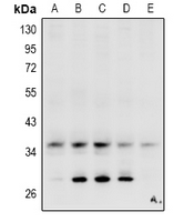 CA4 / Carbonic Anhydrase IV Antibody - Western blot analysis of Carbonic Anhydrase 4 expression in HEK293T (A), HepG2 (B), LO2 (C), AML12 (D), PC12 (E) whole cell lysates.