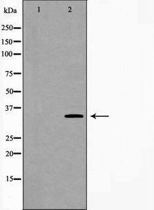 CA4 / Carbonic Anhydrase IV Antibody - Western blot analysis of extracts of mouse fetal lung tissue lysate using CA4 antibody. The lane on the left is treated with the antigen-specific peptide.