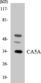 CA5A / Carbonic Anhydrase VA Antibody - Western blot analysis of the lysates from K562 cells using CA5A antibody.