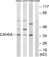CA5A / Carbonic Anhydrase VA Antibody - Western blot analysis of lysates from A549, LOVO, and K562 cells, using CA5A Antibody. The lane on the right is blocked with the synthesized peptide.