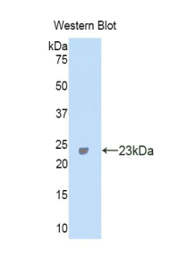 CA5A / Carbonic Anhydrase VA Antibody - Western blot of recombinant CA5A / CAV.  This image was taken for the unconjugated form of this product. Other forms have not been tested.