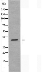 CA5A / Carbonic Anhydrase VA Antibody - Western blot analysis of extracts of A549 cells using CA5A antibody.