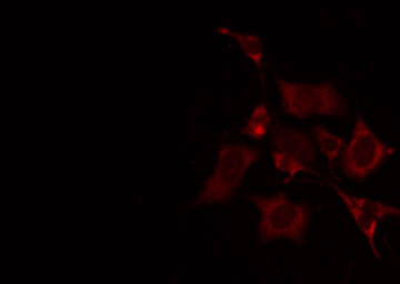 CA5A / Carbonic Anhydrase VA Antibody - Staining A549 cells by IF/ICC. The samples were fixed with PFA and permeabilized in 0.1% Triton X-100, then blocked in 10% serum for 45 min at 25°C. The primary antibody was diluted at 1:200 and incubated with the sample for 1 hour at 37°C. An Alexa Fluor 594 conjugated goat anti-rabbit IgG (H+L) Ab, diluted at 1/600, was used as the secondary antibody.