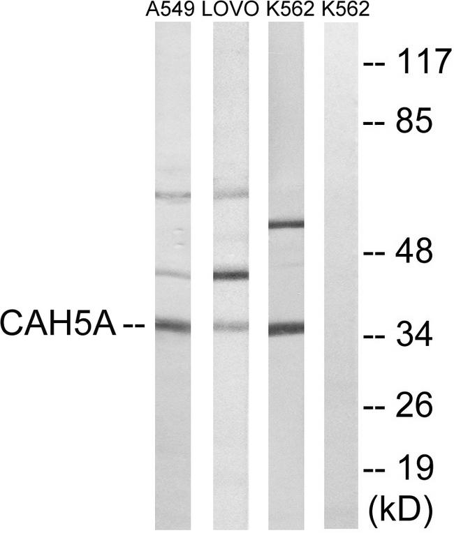 CA5A / Carbonic Anhydrase VA Antibody - Western blot analysis of extracts from A549 cells, LOVO cells and K562 cells, using CA5A antibody.