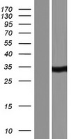 CA5A / Carbonic Anhydrase VA Protein - Western validation with an anti-DDK antibody * L: Control HEK293 lysate R: Over-expression lysate