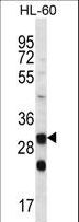 CA6 / Carbonic Anhydrase 6 Antibody - CA6 Antibody western blot of HL-60 cell line lysates (35 ug/lane). The CA6 antibody detected the CA6 protein (arrow).
