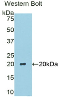 CA6 / Carbonic Anhydrase 6 Antibody - Western blot of recombinant CA6 / Carbonic Anhydrase 6.  This image was taken for the unconjugated form of this product. Other forms have not been tested.