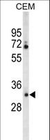 CA6 / Carbonic Anhydrase 6 Antibody - Western blot of CA6 Antibody in CEM cell line lysates (35 ug/lane). CA6 (arrow) was detected using the purified antibody.