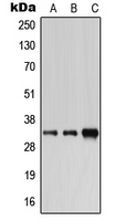 CA6 / Carbonic Anhydrase 6 Antibody - Western blot analysis of Carbonic Anhydrase 6 expression in HEK293T (A); SP2/0 (B); H9C2 (C) whole cell lysates.