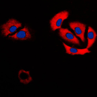 CA6 / Carbonic Anhydrase 6 Antibody - Immunofluorescent analysis of Carbonic Anhydrase 6 staining in H9C2 cells. Formalin-fixed cells were permeabilized with 0.1% Triton X-100 in TBS for 5-10 minutes and blocked with 3% BSA-PBS for 30 minutes at room temperature. Cells were probed with the primary antibody in 3% BSA-PBS and incubated overnight at 4 C in a humidified chamber. Cells were washed with PBST and incubated with a DyLight 594-conjugated secondary antibody (red) in PBS at room temperature in the dark. DAPI was used to stain the cell nuclei (blue).