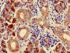 CA6 / Carbonic Anhydrase 6 Antibody - Immunohistochemistry of paraffin-embedded human salivary gland tissue at dilution of 1:100