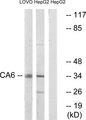 CA6 / Carbonic Anhydrase 6 Antibody - Western blot analysis of extracts from LOVO cells and HepG2 cells, using CA6 antibody.