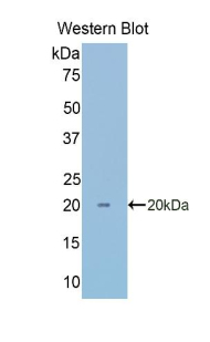 CA7 / Carbonic Anhydrase VII Antibody - Western blot of recombinant CA7 / Carbonic Anhydrase VII.  This image was taken for the unconjugated form of this product. Other forms have not been tested.