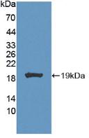 CA7 / Carbonic Anhydrase VII Antibody - Western Blot; Sample: Recombinant CA7, Mouse.