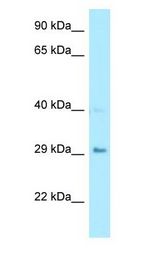 CA7 / Carbonic Anhydrase VII Antibody - CA7 / Carbonic Anhydrase VII antibody Western Blot of Fetal Bladder.  This image was taken for the unconjugated form of this product. Other forms have not been tested.