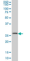 CA7 / Carbonic Anhydrase VII Antibody - CA7 monoclonal antibody (M06), clone 3B7 Western Blot analysis of CA7 expression in HeLa NE.