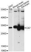 CA7 / Carbonic Anhydrase VII Antibody - Western blot analysis of extracts of various cell lines, using CA7 antibody at 1:3000 dilution. The secondary antibody used was an HRP Goat Anti-Rabbit IgG (H+L) at 1:10000 dilution. Lysates were loaded 25ug per lane and 3% nonfat dry milk in TBST was used for blocking. An ECL Kit was used for detection and the exposure time was 90s.