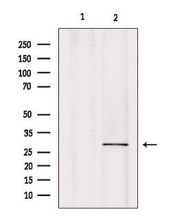 CA7 / Carbonic Anhydrase VII Antibody - Western blot analysis of extracts of mouse brain tissue using CA7 antibody. Lane 1 was treated with the blocking peptide.