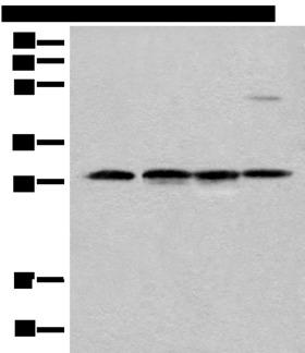 CA7 / Carbonic Anhydrase VII Antibody - Western blot analysis of Human urinary bladder tissue Mouse heart tissue Mouse kidney tissue and RAW264.7 cell lysates  using CA7 Polyclonal Antibody at dilution of 1:500