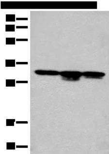 CA7 / Carbonic Anhydrase VII Antibody - Western blot analysis of RAW264.7 cell Mouse kidney tissue and Mouse heart tissue lysates  using CA7 Polyclonal Antibody at dilution of 1:400