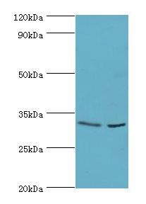 CA8 / Carbonic Anhydrase VIII Antibody - Western blot. All lanes: CA8 antibody at 4 ug/ml. Lane 1: mouse skeletal muscle tissue. Lane 2: mouse liver tissue. Secondary antibody: Goat polyclonal to rabbit at 1:10000 dilution. Predicted band size: 33 kDa. Observed band size 33 kDa.