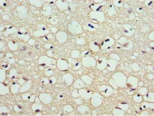 CA8 / Carbonic Anhydrase VIII Antibody - Immunohistochemistry of paraffin-embedded human brain tissue using antibody at 1:100 dilution.
