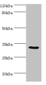 CA8 / Carbonic Anhydrase VIII Antibody - Western blot All lanes: CA8 antibody at 8µg/ml + Mouse liver tissue Secondary Goat polyclonal to rabbit IgG at 1/10000 dilution Predicted band size: 33 kDa Observed band size: 33 kDa