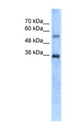 CA8 / Carbonic Anhydrase VIII Antibody - CA8 / Carbonic Anhydrase VIII antibody ARP42166_T100-NP_004047-CA8(carbonic anhydrase VIII) Antibody Western blot of SK-MEL-2 cell lysate.  This image was taken for the unconjugated form of this product. Other forms have not been tested.