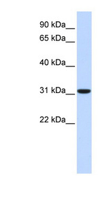 CA8 / Carbonic Anhydrase VIII Antibody - CA8 / Carbonic Anhydrase VIII antibody Western blot of Fetal Liver lysate. This image was taken for the unconjugated form of this product. Other forms have not been tested.