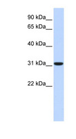 CA8 / Carbonic Anhydrase VIII Antibody - CA8 / Carbonic Anhydrase VIII antibody Western blot of Fetal Liver lysate. This image was taken for the unconjugated form of this product. Other forms have not been tested.