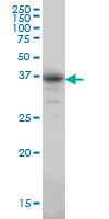 CA8 / Carbonic Anhydrase VIII Antibody - CA8 monoclonal antibody (M01), clone 1F7 Western Blot analysis of CA8 expression in A-549.